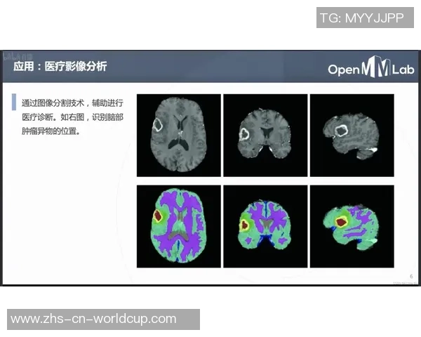 重庆排球队包夹战术深度解析与实战应用探讨